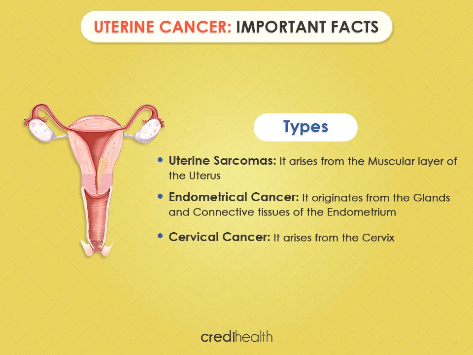 uterine cancer