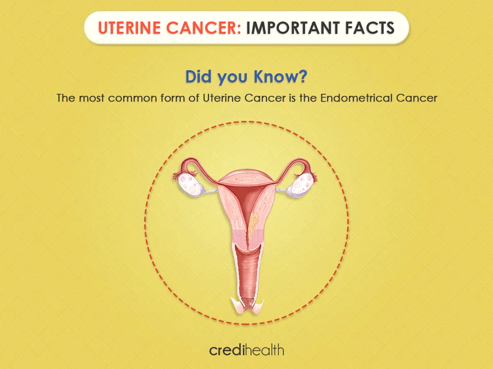 uterine cancer