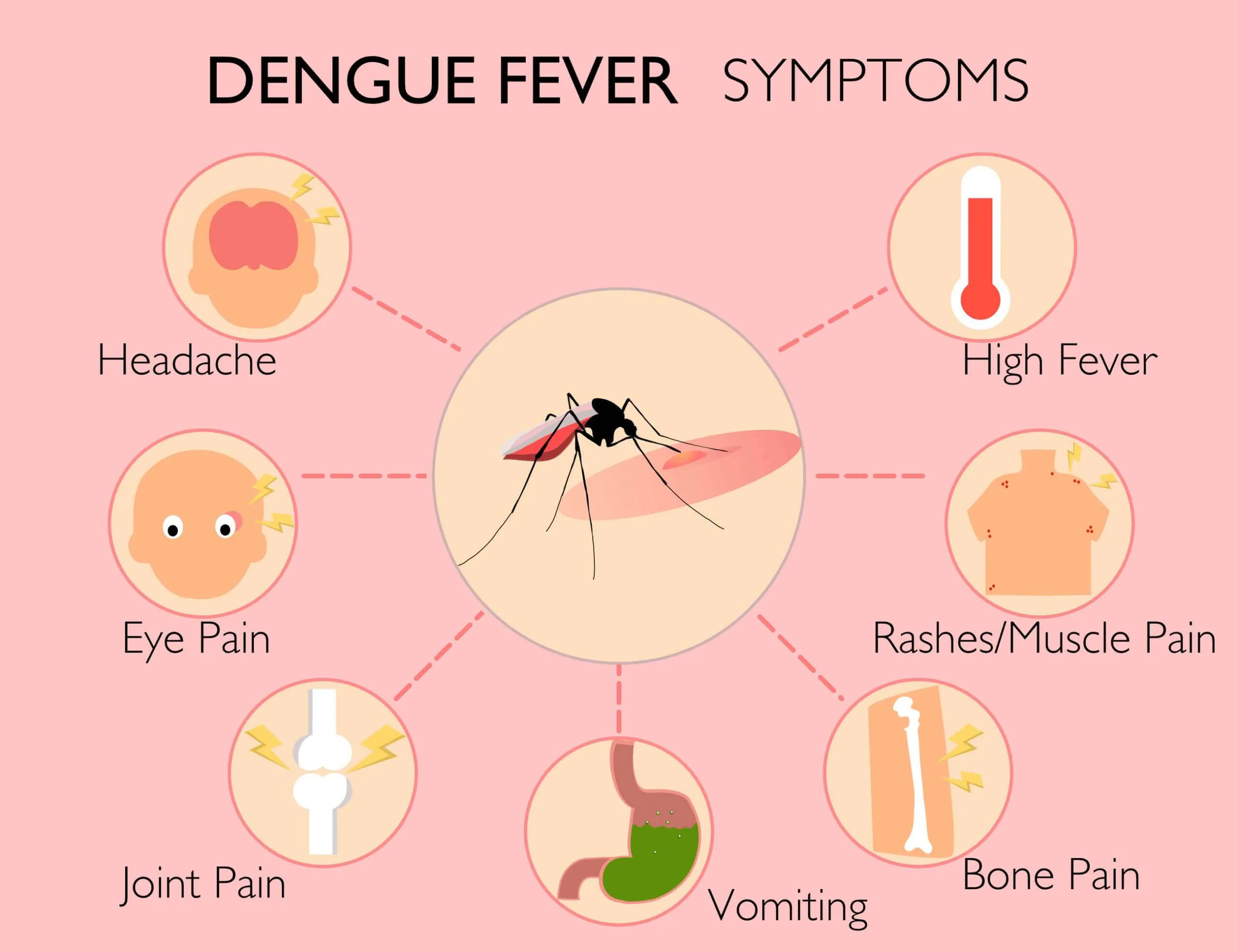 Symptoms of Dengue Fever