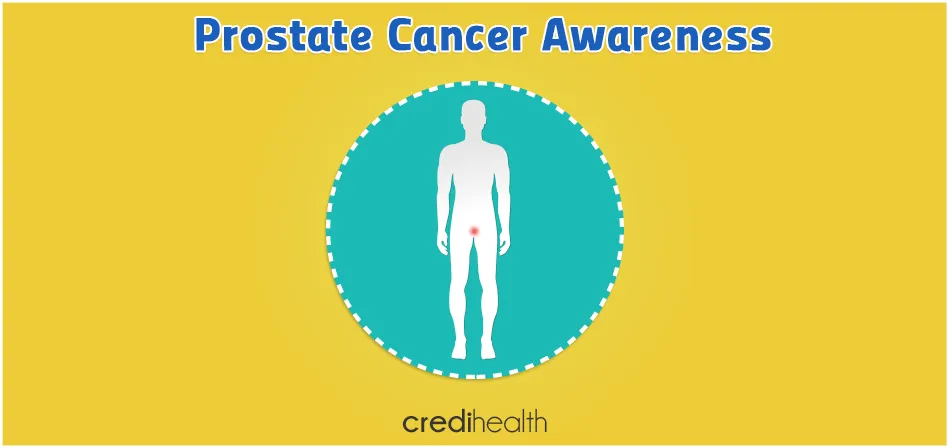 Things To Know For Advanced Prostate Cancer Patients