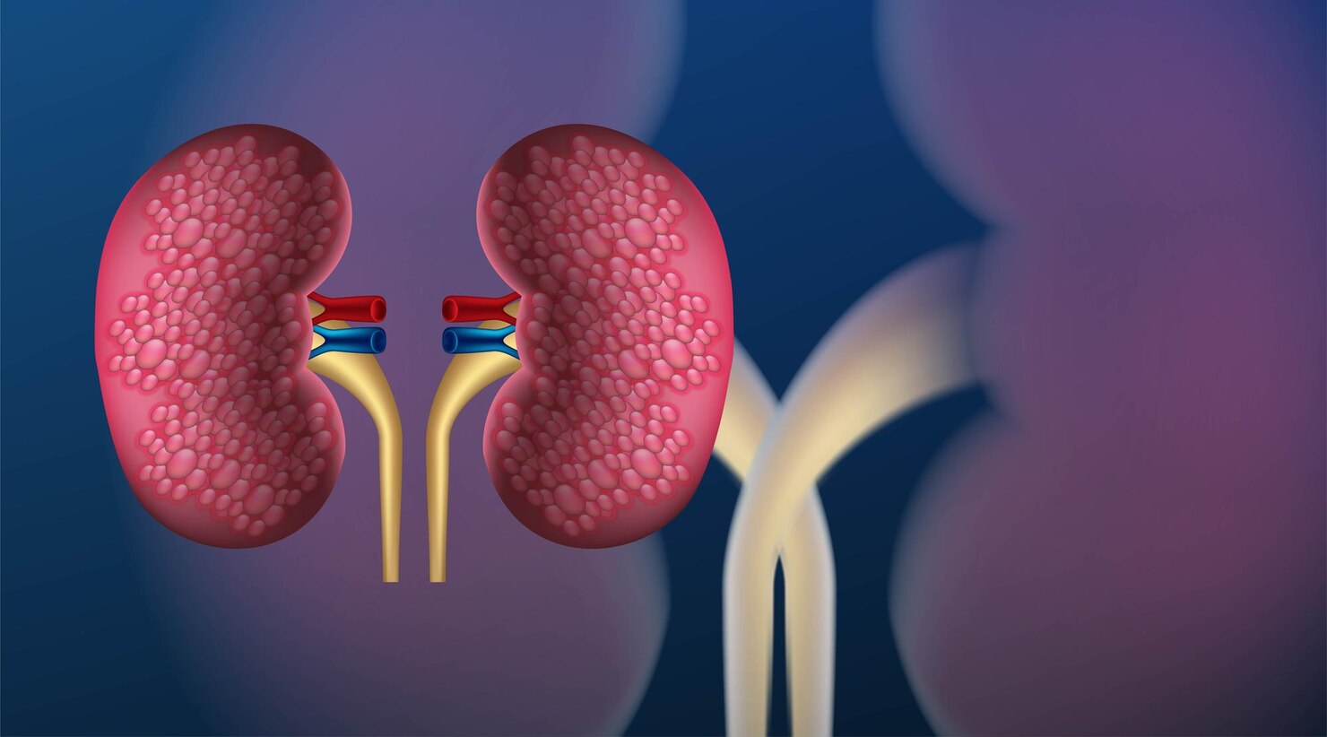 Lithotripsy FAQS